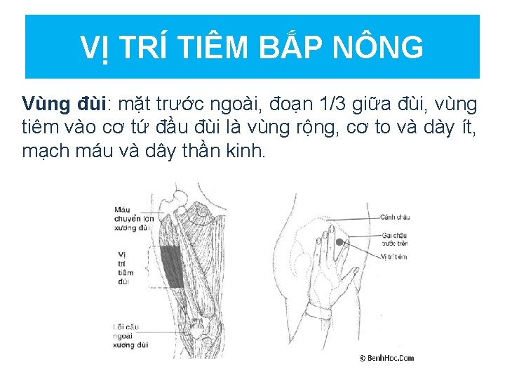 VỊ TRÍ TIÊM BẮP NÔNG Vùng đùi: mặt trước ngoài, đoạn 1/3 giữa đùi,