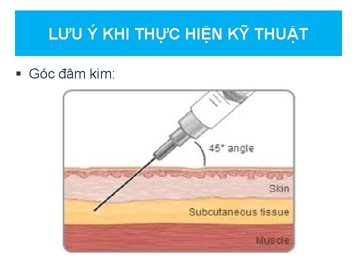 LƯU Ý KHI THỰC HIỆN KỸ THUẬT § Góc đâm kim: 