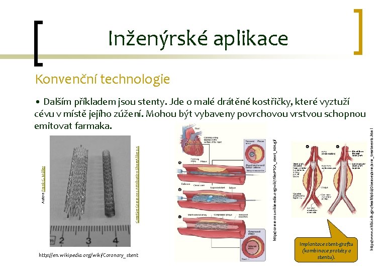 Inženýrské aplikace http: //en. wikipedia. org/wiki/Coronary_stent http: //commons. wikimedia. org/wiki/File: PTCA_stent_NIH. gif Creative Commons