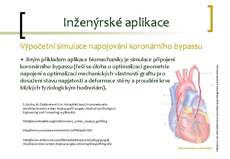 Inženýrské aplikace • Jiným příkladem aplikace biomechaniky je simulace připojení koronárního bypassu (řeší se