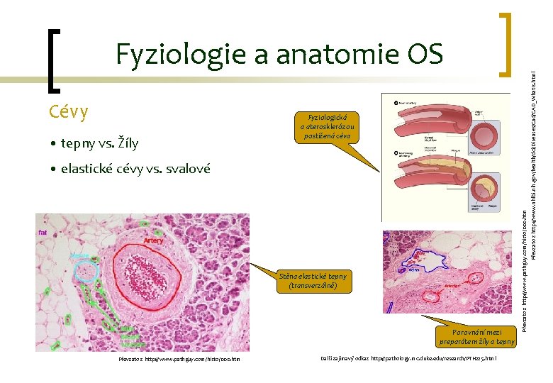 Cévy • tepny vs. Žíly Fyziologická a aterosklerózou postižená céva Stěna elastické tepny (transverzálně)