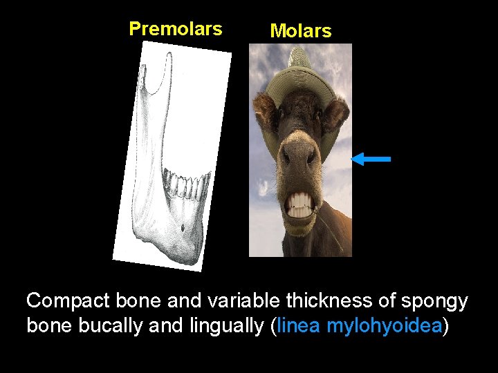 Premolars Molars Compact bone and variable thickness of spongy bone bucally and lingually (linea