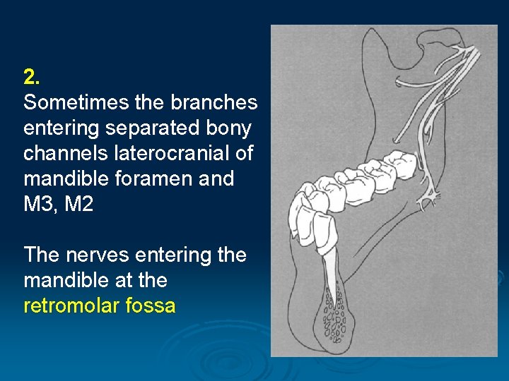 2. Sometimes the branches entering separated bony channels laterocranial of mandible foramen and M