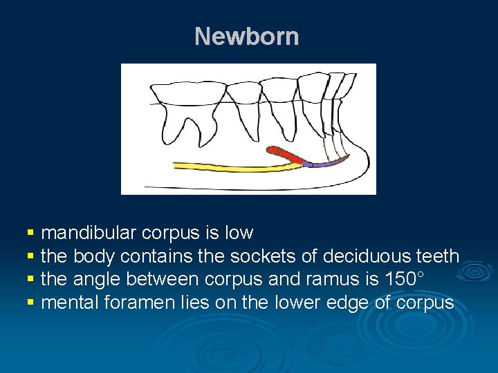 Newborn § mandibular corpus is low § the body contains the sockets of deciduous