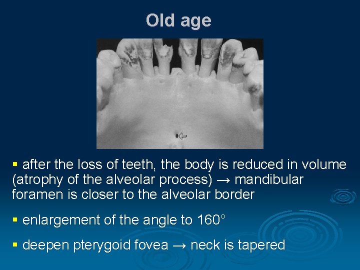 Old age § after the loss of teeth, the body is reduced in volume