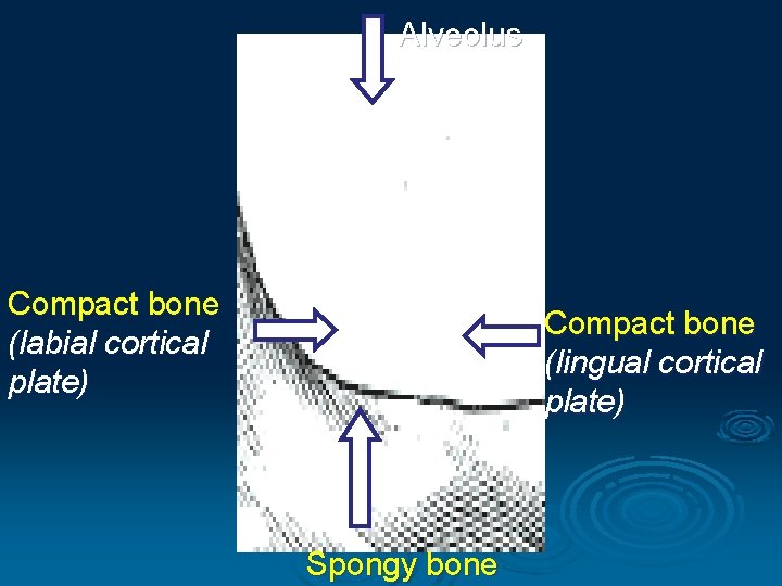 Alveolus Compact bone (labial cortical plate) Compact bone (lingual cortical plate) Spongy bone 