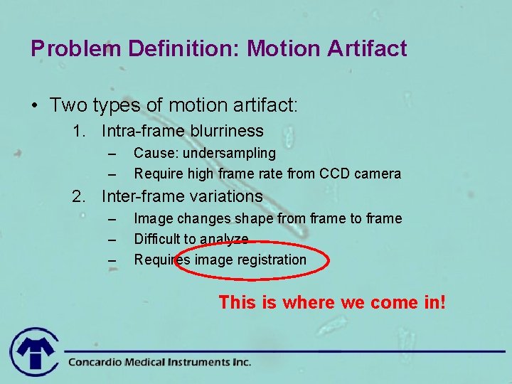 Problem Definition: Motion Artifact • Two types of motion artifact: 1. Intra-frame blurriness –