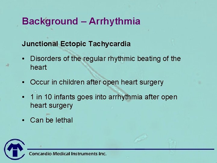 Background – Arrhythmia Junctional Ectopic Tachycardia • Disorders of the regular rhythmic beating of