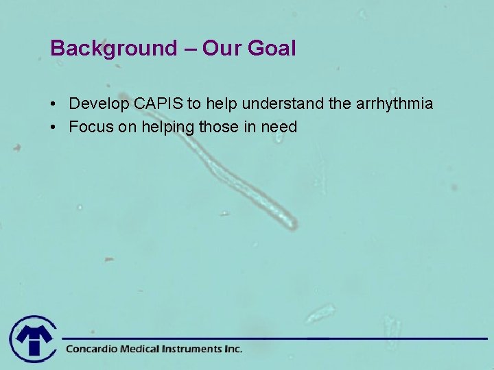 Background – Our Goal • Develop CAPIS to help understand the arrhythmia • Focus