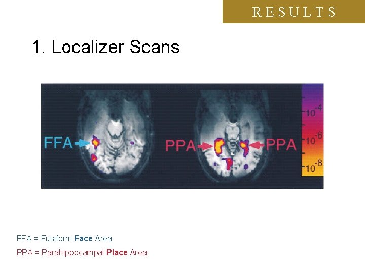 RESULTS 1. Localizer Scans FFA = Fusiform Face Area PPA = Parahippocampal Place Area