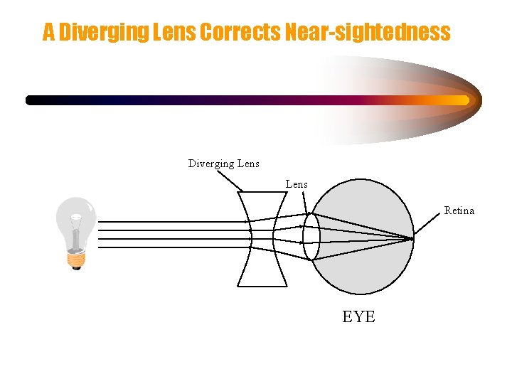 A Diverging Lens Corrects Near-sightedness Diverging Lens Retina EYE 