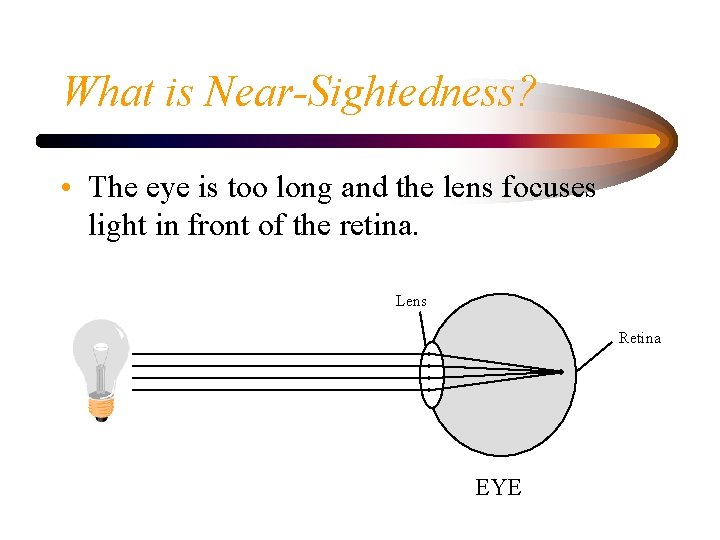 What is Near-Sightedness? • The eye is too long and the lens focuses light
