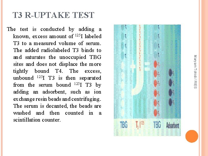 T 3 R-UPTAKE TEST Maryam Tohidi / RIES The test is conducted by adding