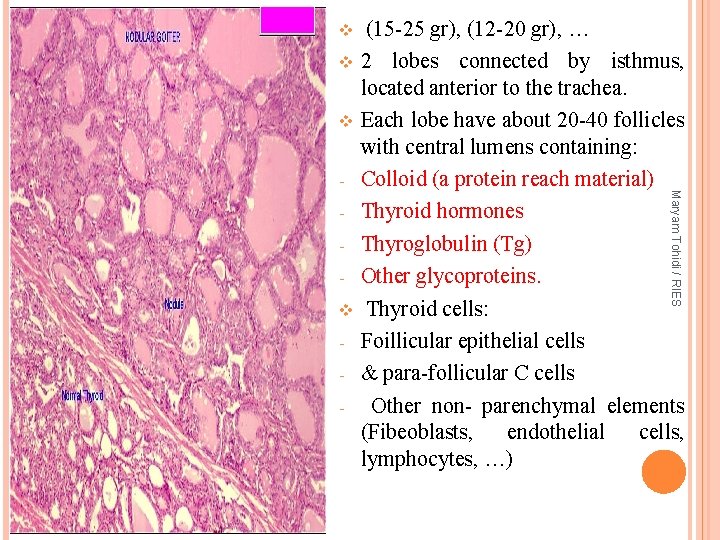 v v v - Maryam Tohidi / RIES - (15 -25 gr), (12 -20