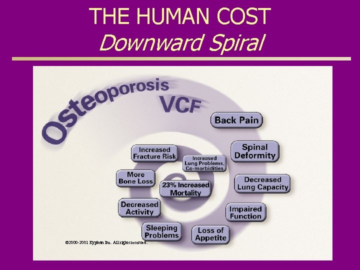 THE HUMAN COST Downward Spiral © 2000 -2001 Kyphon Inc. All rights reserved. 