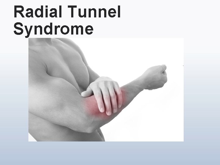 Radial Tunnel Syndrome 
