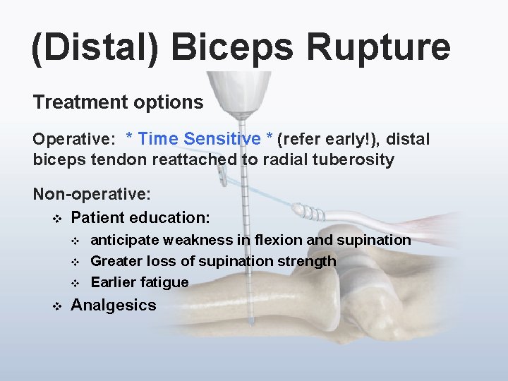 (Distal) Biceps Rupture Treatment options Operative: * Time Sensitive * (refer early!), distal biceps