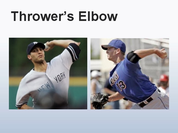 Thrower’s Elbow 