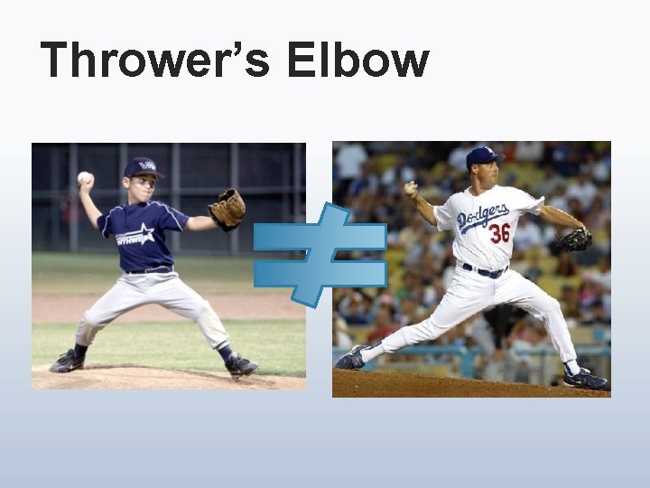 Thrower’s Elbow 