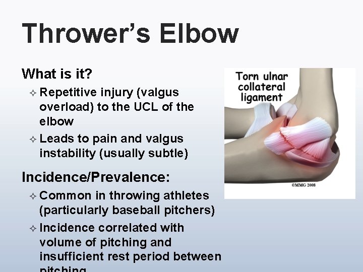 Thrower’s Elbow What is it? ² Repetitive injury (valgus overload) to the UCL of
