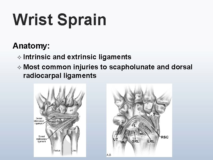 Wrist Sprain Anatomy: ² Intrinsic and extrinsic ligaments ² Most common injuries to scapholunate