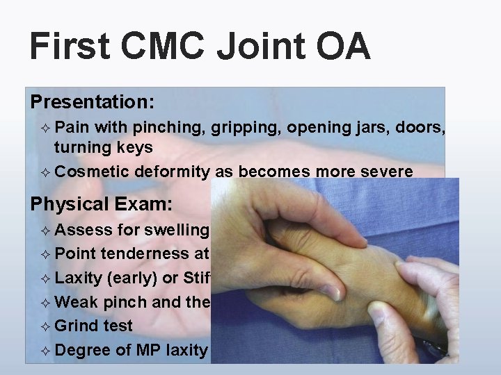 First CMC Joint OA Presentation: ² Pain with pinching, gripping, opening jars, doors, turning
