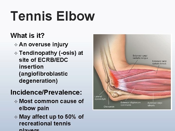 Tennis Elbow What is it? ² An overuse injury ² Tendinopathy (-osis) at site