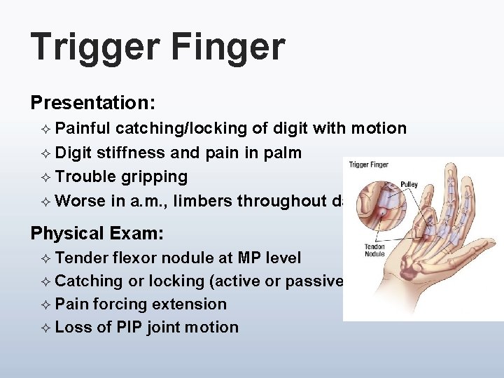 Trigger Finger Presentation: ² Painful catching/locking of digit with motion ² Digit stiffness and