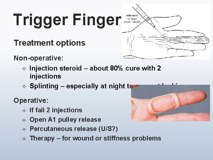 Trigger Finger Treatment options Non-operative: ² Injection steroid – about 80% cure with 2