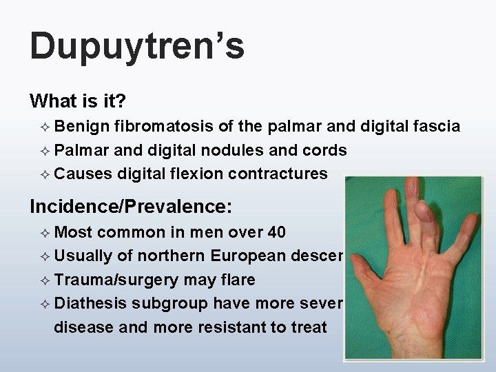 Dupuytren’s What is it? ² Benign fibromatosis of the palmar and digital fascia ²