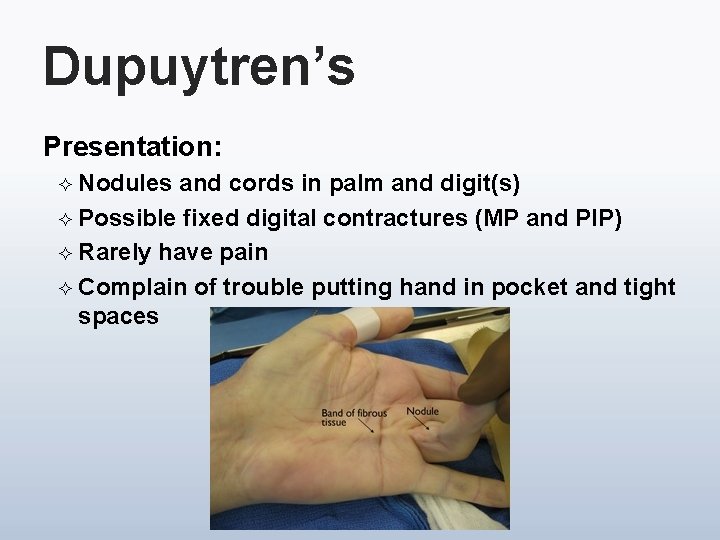 Dupuytren’s Presentation: ² Nodules and cords in palm and digit(s) ² Possible fixed digital