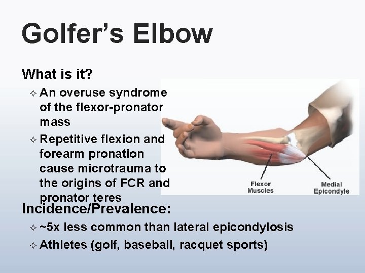 Golfer’s Elbow What is it? ² An overuse syndrome of the flexor-pronator mass ²