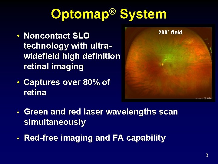 Optomap® System • Noncontact SLO technology with ultrawidefield high definition retinal imaging 200° field