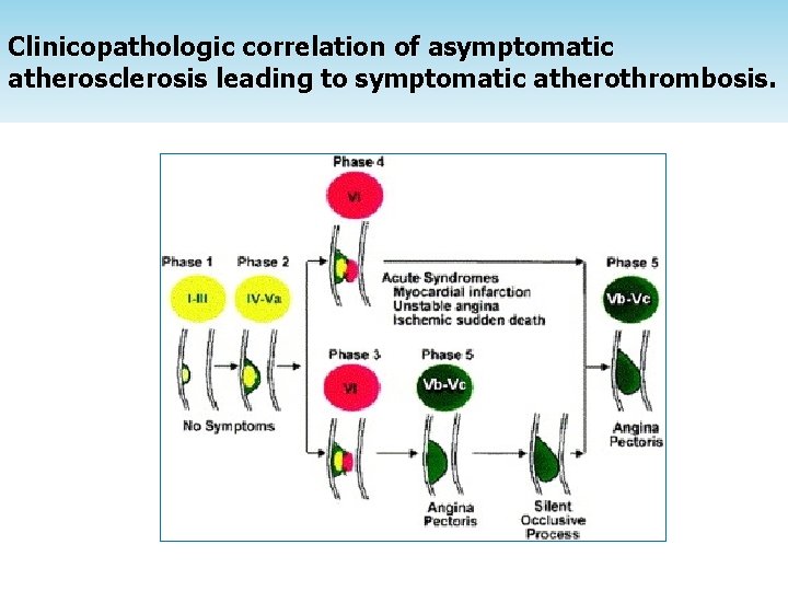 Clinicopathologic correlation of asymptomatic atherosclerosis leading to symptomatic atherothrombosis. 