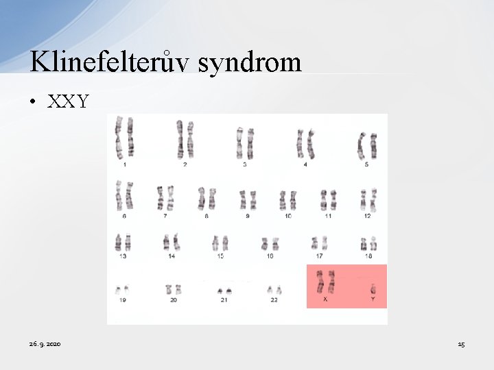 Klinefelterův syndrom • XXY 26. 9. 2020 15 