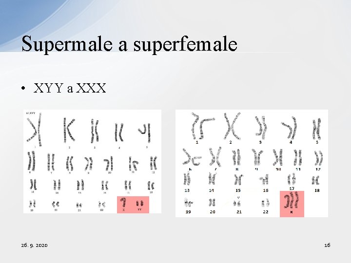 Supermale a superfemale • XYY a XXX 26. 9. 2020 16 