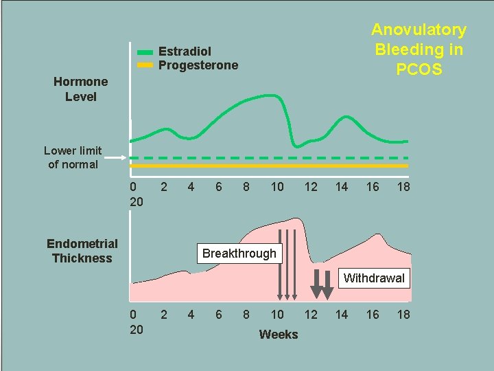 Anovulatory Bleeding in PCOS Estradiol Progesterone Hormone Level Lower limit of normal 0 20