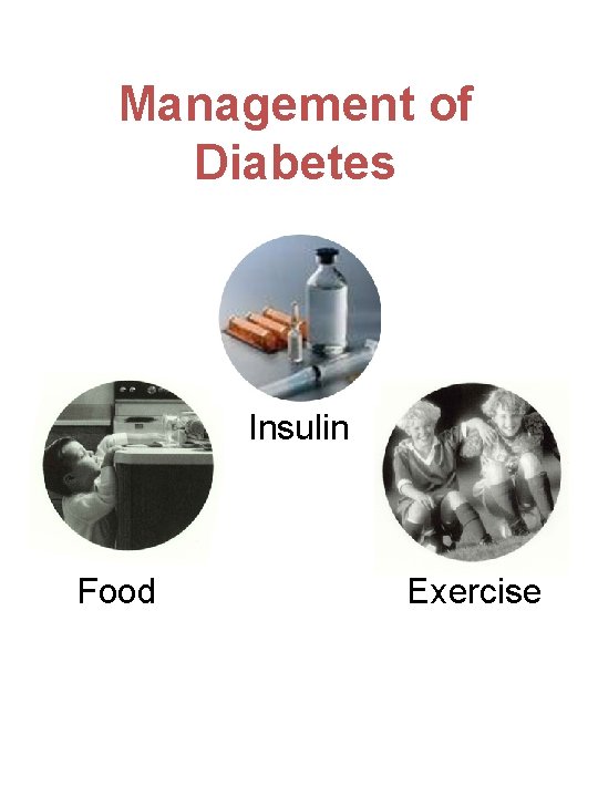 Management of Diabetes Insulin Food Exercise 