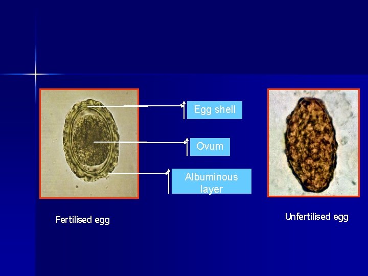 Egg shell Ovum Albuminous layer Fertilised egg Unfertilised egg 