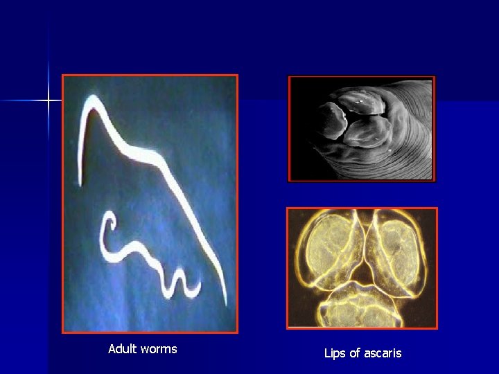 Adult worms Lips of ascaris 