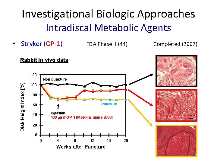 Investigational Biologic Approaches Intradiscal Metabolic Agents • Stryker (OP-1) FDA Phase II (44) Rabbit