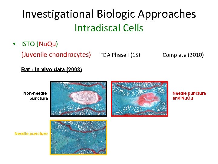 Investigational Biologic Approaches Intradiscal Cells • ISTO (Nu. Qu) (Juvenile chondrocytes) FDA Phase I