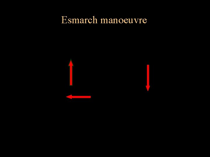 Esmarch manoeuvre tilt head back lift chin 