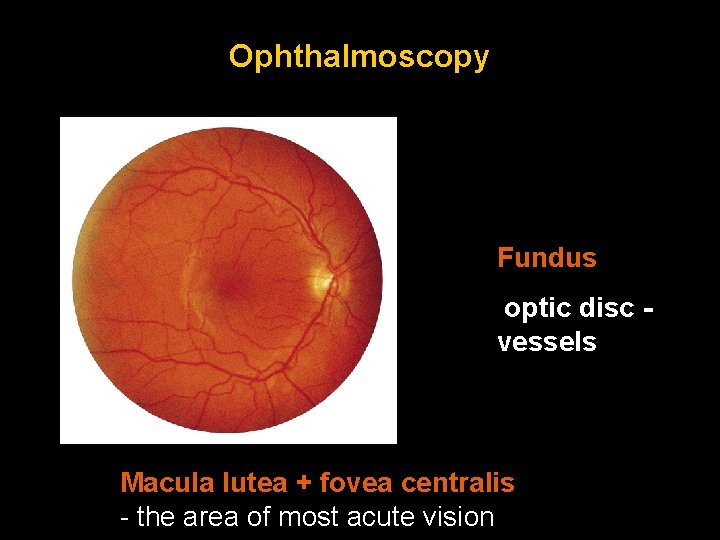 Ophthalmoscopy Fundus optic disc vessels Macula lutea + fovea centralis - the area of
