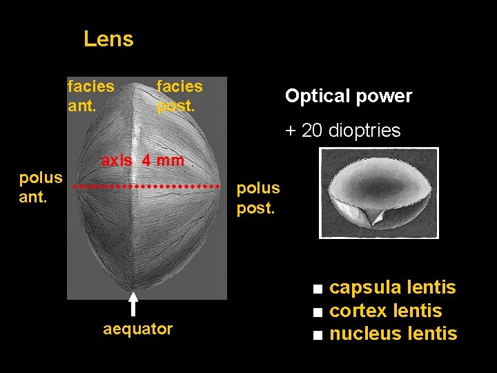 Lens facies ant. facies post. Optical power + 20 dioptries polus ant. axis 4