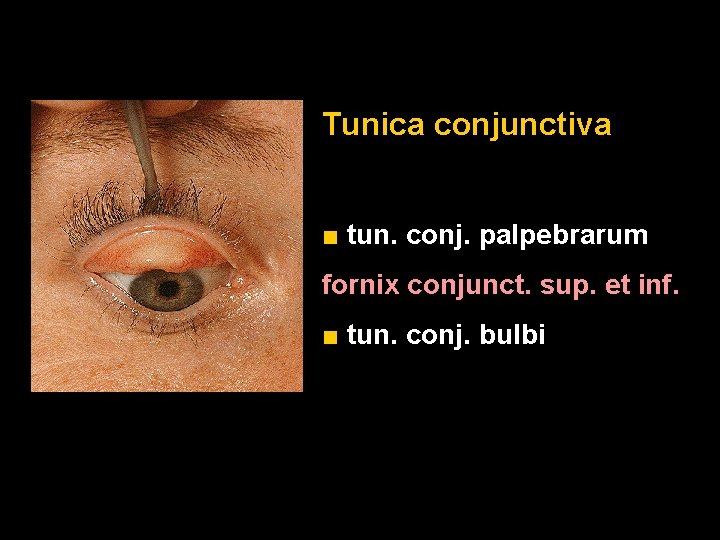 Tunica conjunctiva ■ tun. conj. palpebrarum fornix conjunct. sup. et inf. ■ tun. conj.