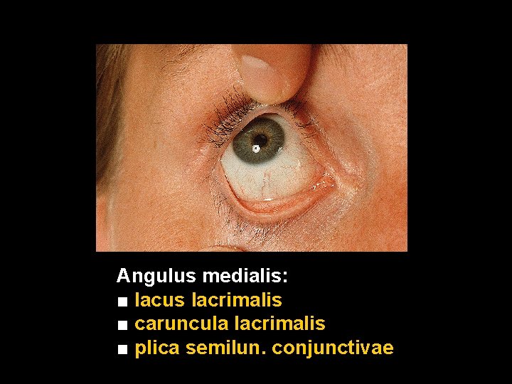 Angulus medialis: ■ lacus lacrimalis ■ caruncula lacrimalis ■ plica semilun. conjunctivae 