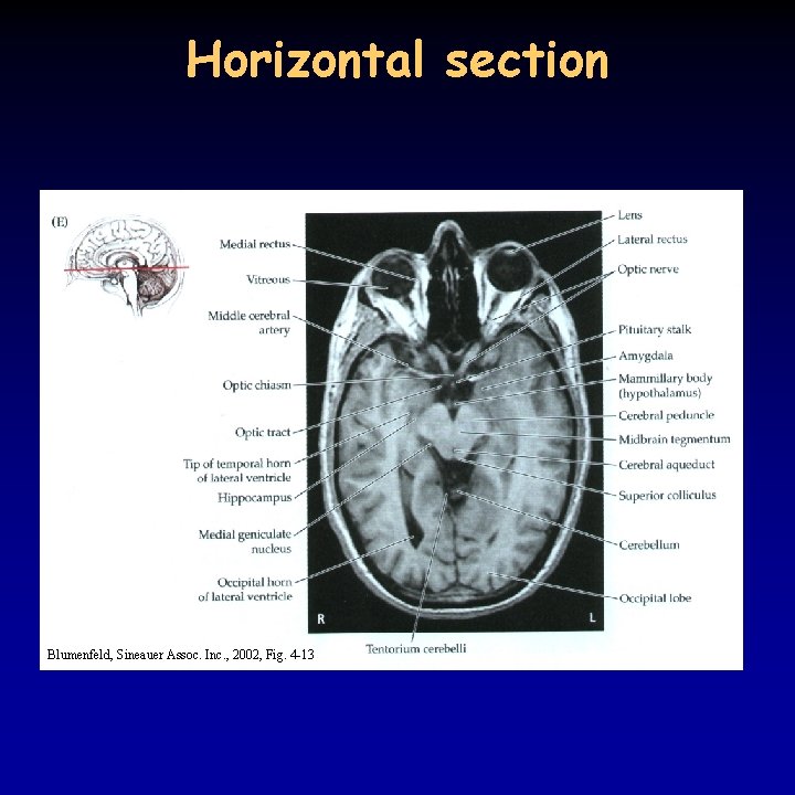 Horizontal section Blumenfeld, Sineauer Assoc. Inc. , 2002, Fig. 4 -13 
