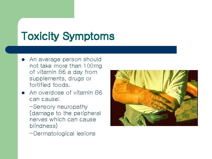 Toxicity Symptoms l l An average person should not take more than 100 mg