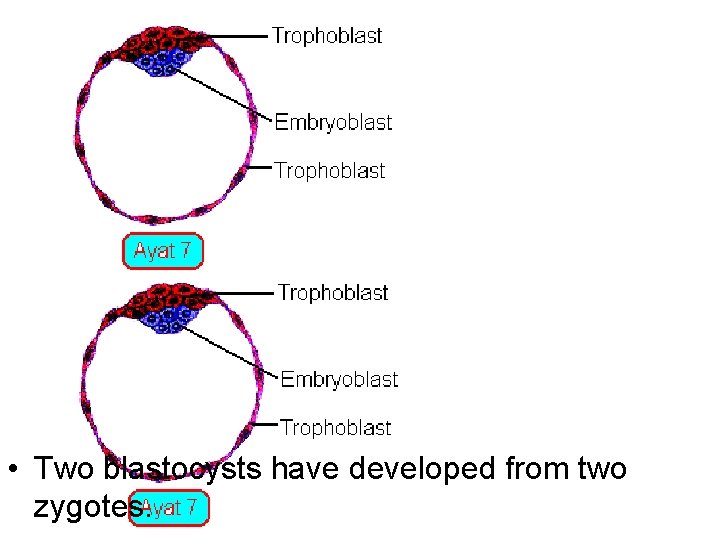  • Two blastocysts have developed from two zygotes. 